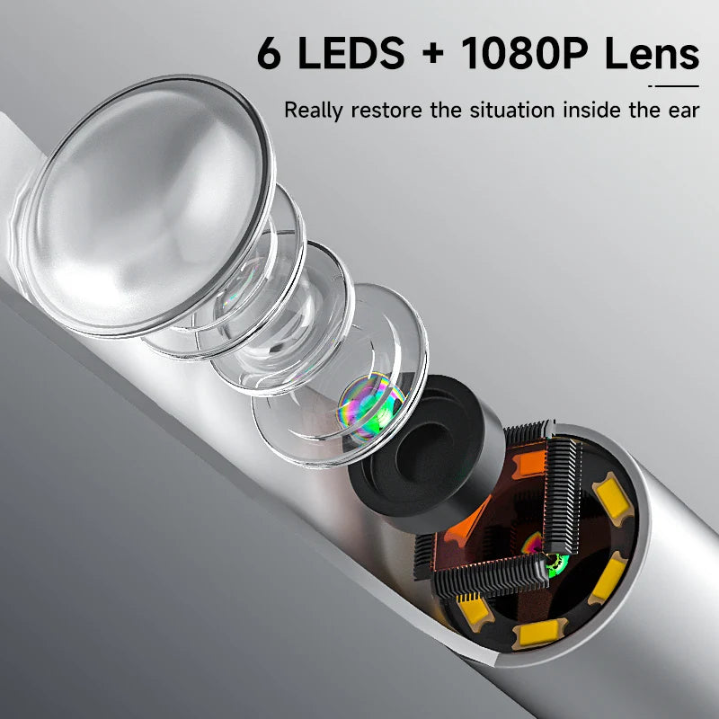 Wireless Visual Otoscope
