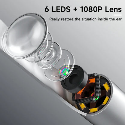 Wireless Visual Otoscope