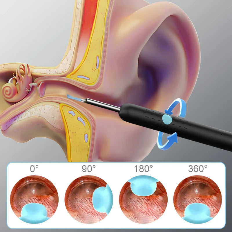 Wireless Visual Otoscope