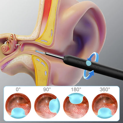 Wireless Visual Otoscope